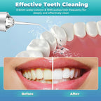 Dental Flosser Water Jet for Your Teeth