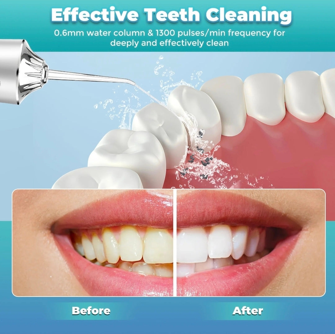 Dental Flosser Water Jet for Your Teeth